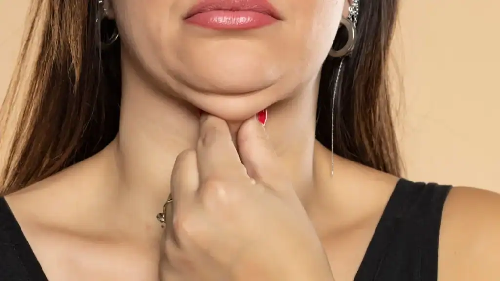 An image of a woman with double chin, sad, worried : Non Surgical Double Chin Removal Treatment in Kingston upon Thames, UK