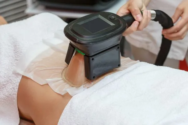 Image of person having fat freezing treatment to help weight gain Kingston upon Thames