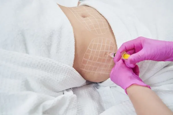 image of fat dissolving injections on love handles to help combat weight gain Kingston upon Thames