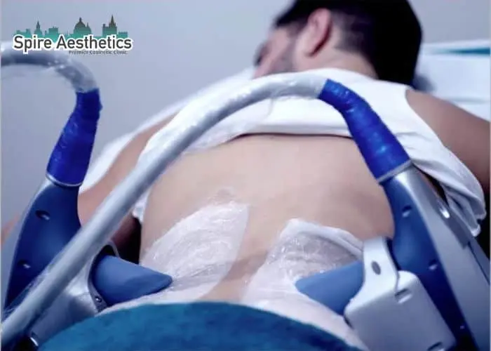 Man having fat freezing treatment done on love handles before a competitions Kingston upon Thames to create a sculpted look.