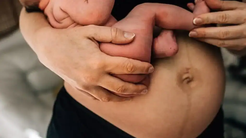 Why Is My Stomach Still Big After Pregnancy Kingston upon Thames?